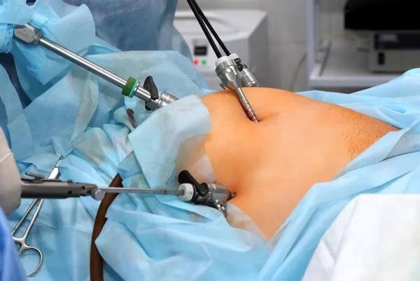 Laparoscopic Surgery